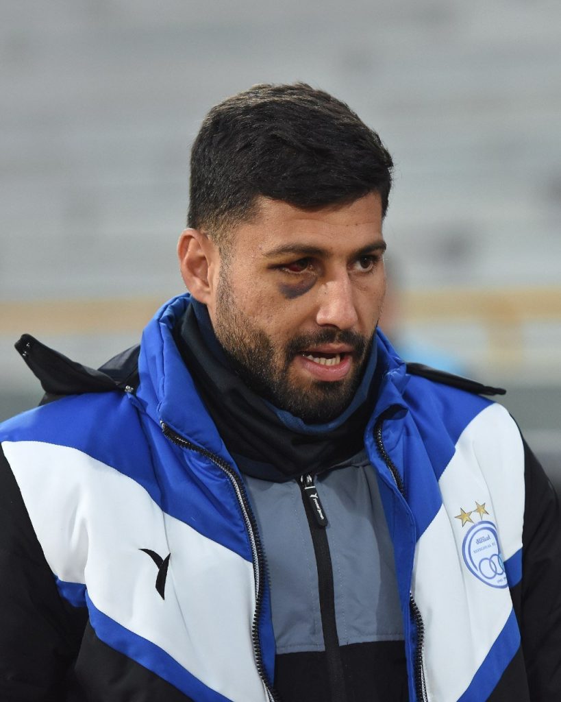 عکس| حالت ترسناک صدمه دیدن چشم دفاع کننده استقلال » اصفهانیا