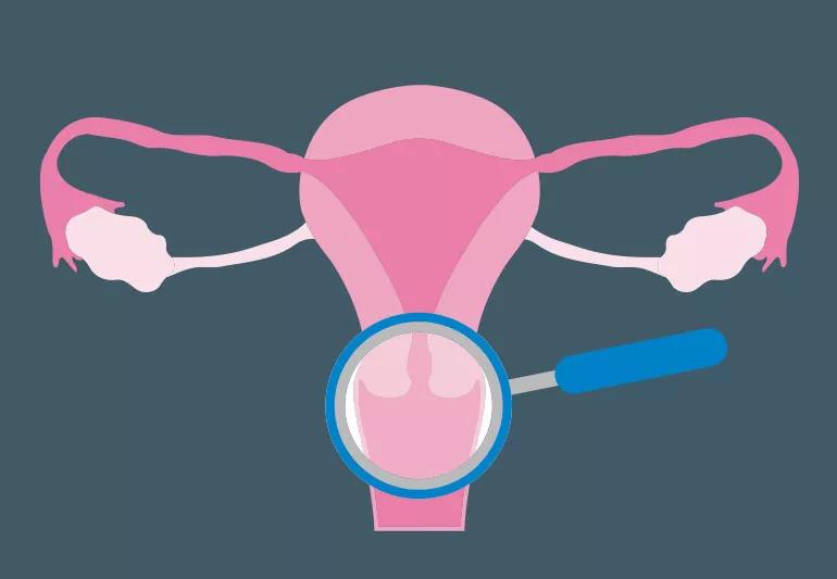 What to Expect After an Abnormal Pap Smear