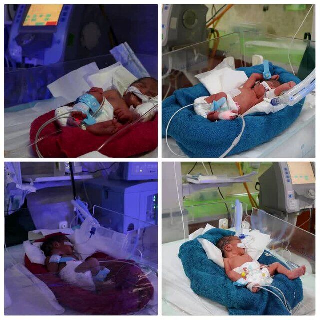 تولد ۴ قلوهای پسر در سومین زایمان مادر کاشانی