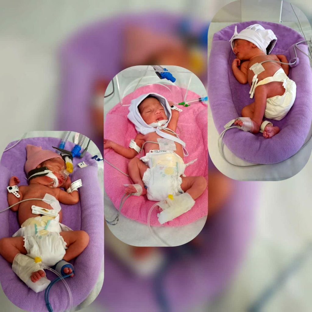 تولد چهل و یکمین نوزاد ۳ قلوی استان در بیمارستان شریعتی