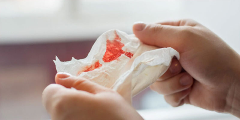 آیا خونریزی سپس از ایمپلنت دندان طبیعی است؟ 4 a8bc130f-b89a-407e-a450-1e6368e28d83