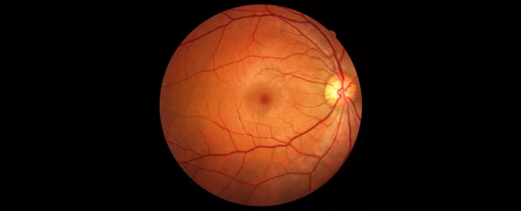 رگ‌های چشم احتمالا بتواند به تشخیص زودهنگام زوال عقل پشتیبانی کند_اصفهانیا