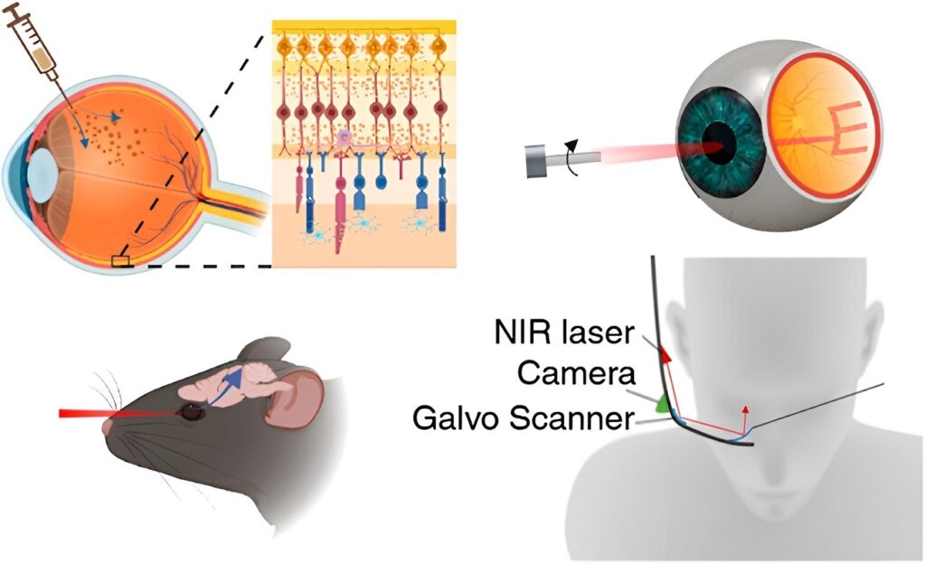 تزریق نانوذرات طلا به چشم!