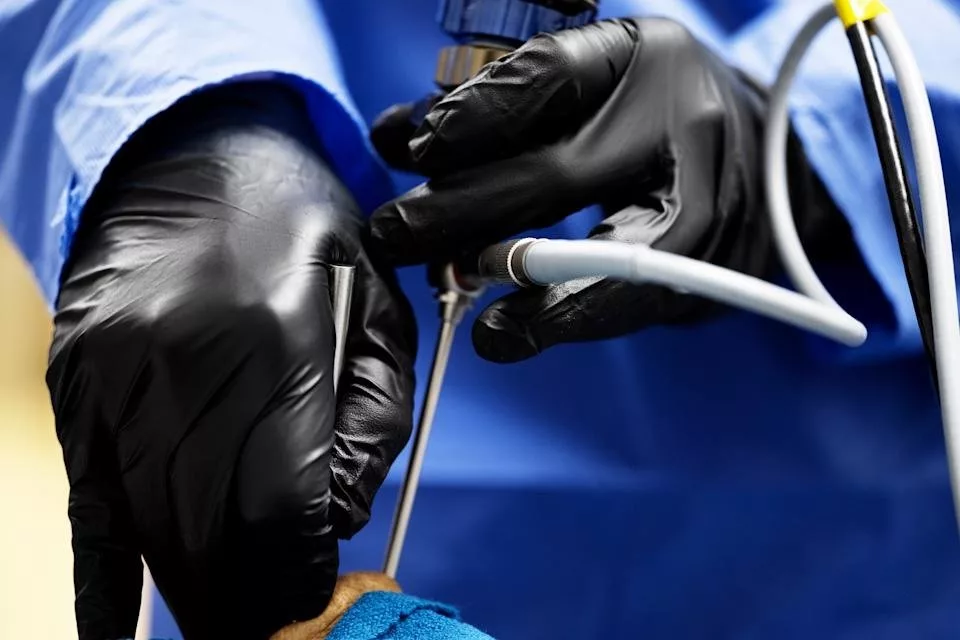 پزشکان تومور نخاعی را از حدقه چشم خارج کردند_اصفهانیا