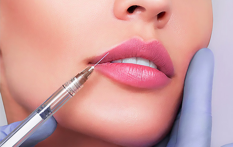تزریق ژل لب (1)